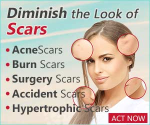 diminish the look of acne scars